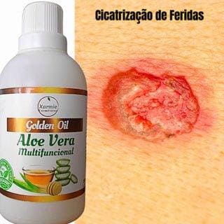 Óleo de Aloe Vera Babosa para Feridas - Regeneração e Alívio 100ml Natural - Apple Hapy 
